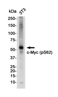 Phospho-c-Myc (Ser62) Rabbit mAb