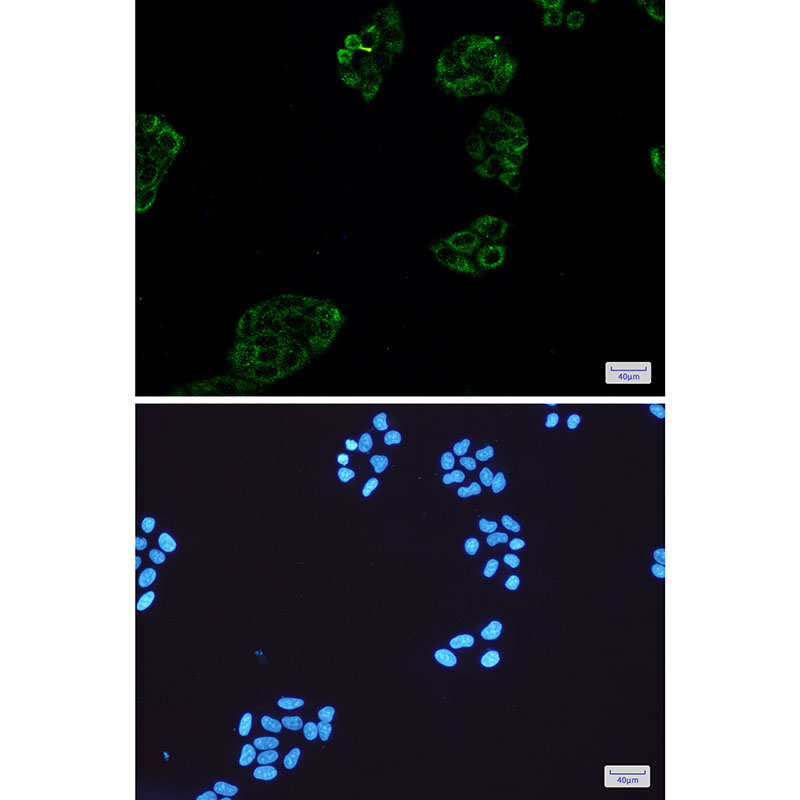 Collagen III alpha 1 Rabbit mAb