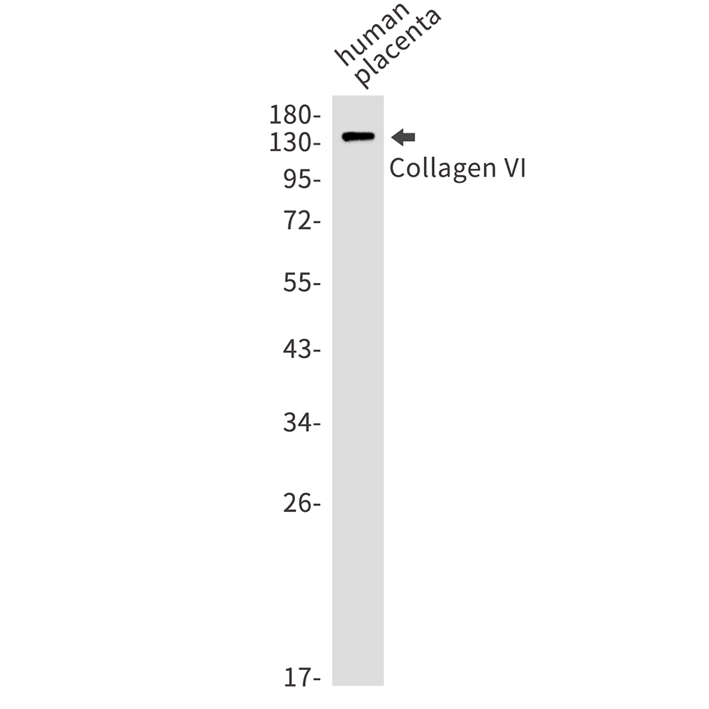 Collagen VI alpha 1 Rabbit mAb