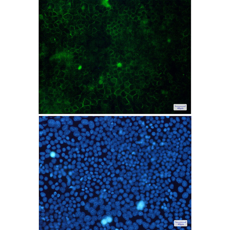 Cortactin Rabbit mAb