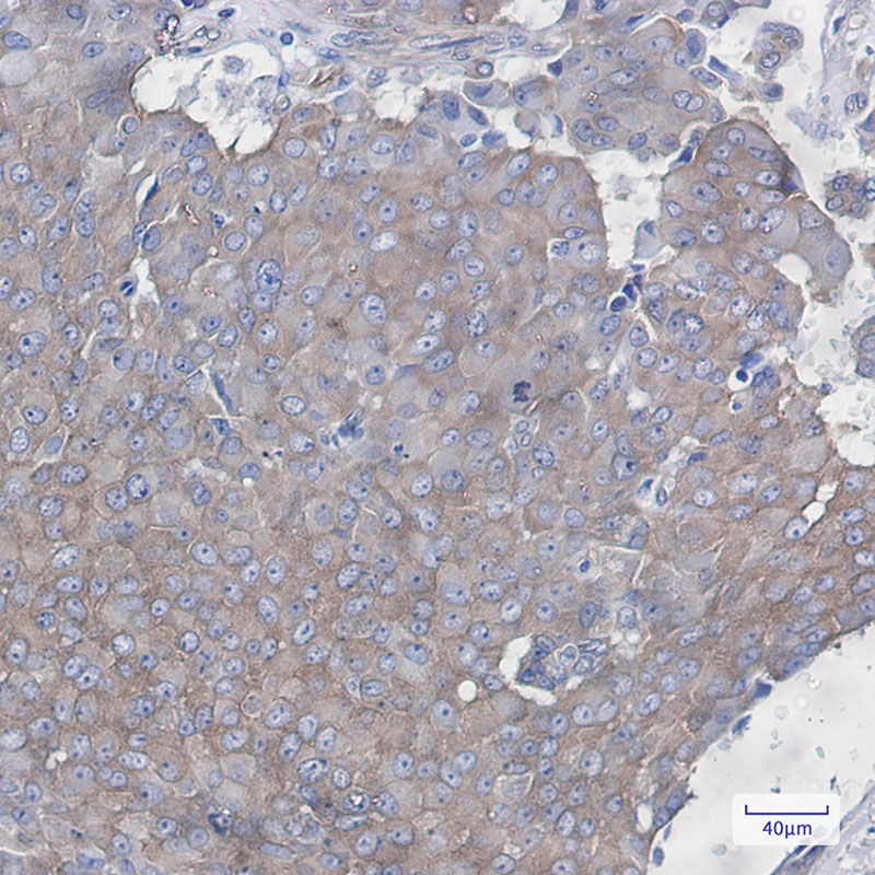 Cortactin Rabbit mAb