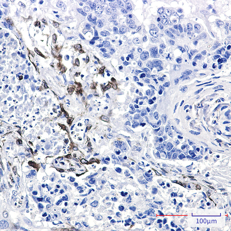 Cyclooxygenase 2 Rabbit mAb