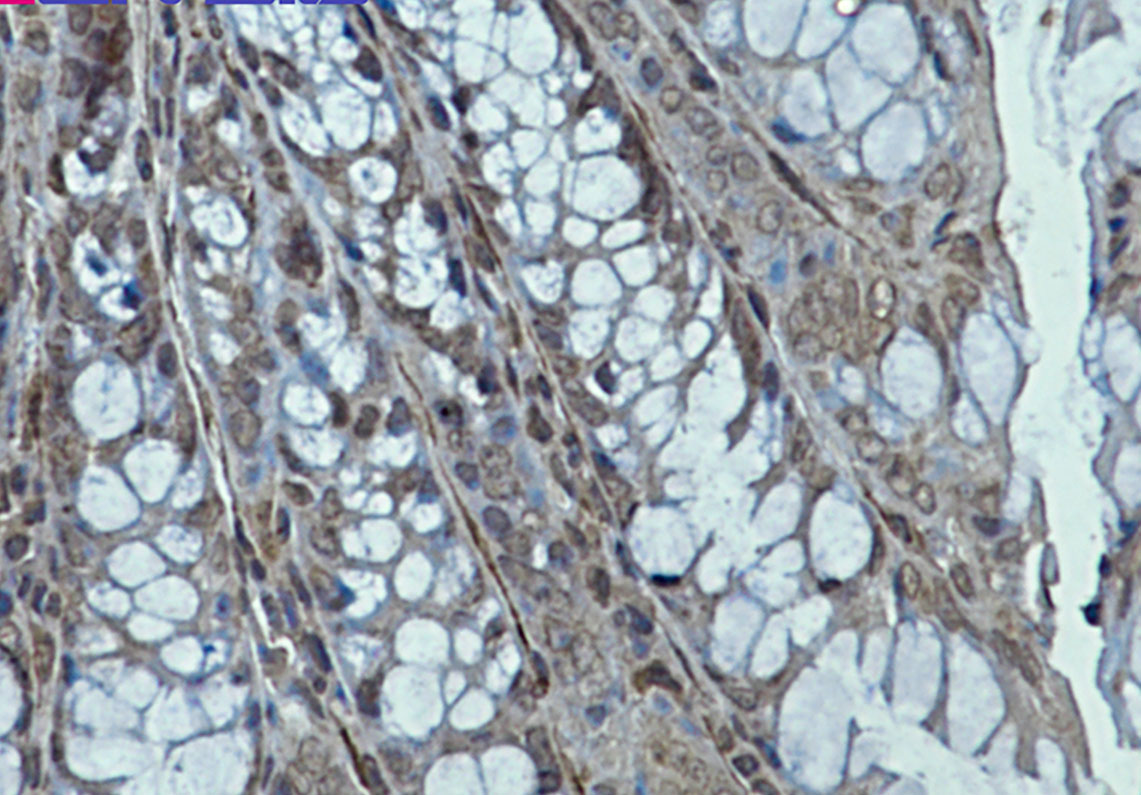 Creatine Kinase B type Rabbit mAb