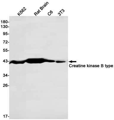 Creatine Kinase B type Rabbit mAb