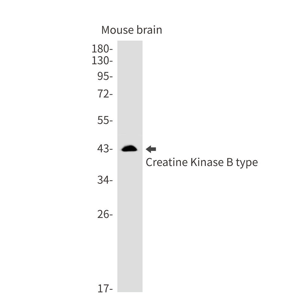 Creatine Kinase B type Rabbit mAb