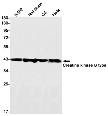 Creatine Kinase B type Rabbit mAb