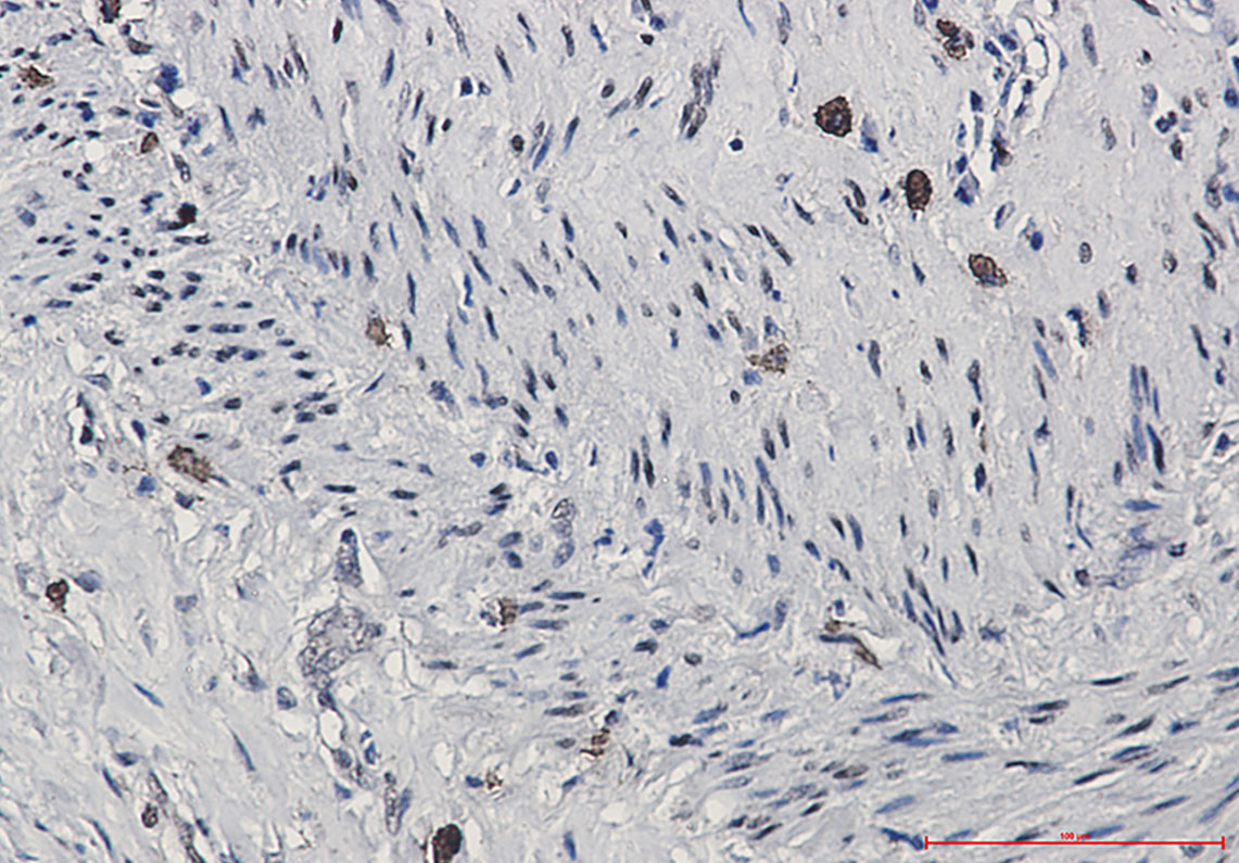 Phospho-CREB (Ser133) Rabbit mAb