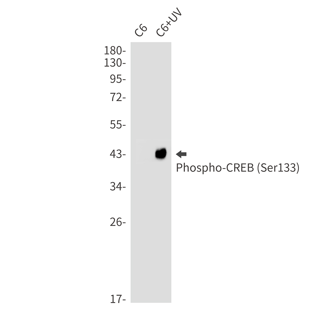 Phospho-CREB (Ser133) Rabbit mAb