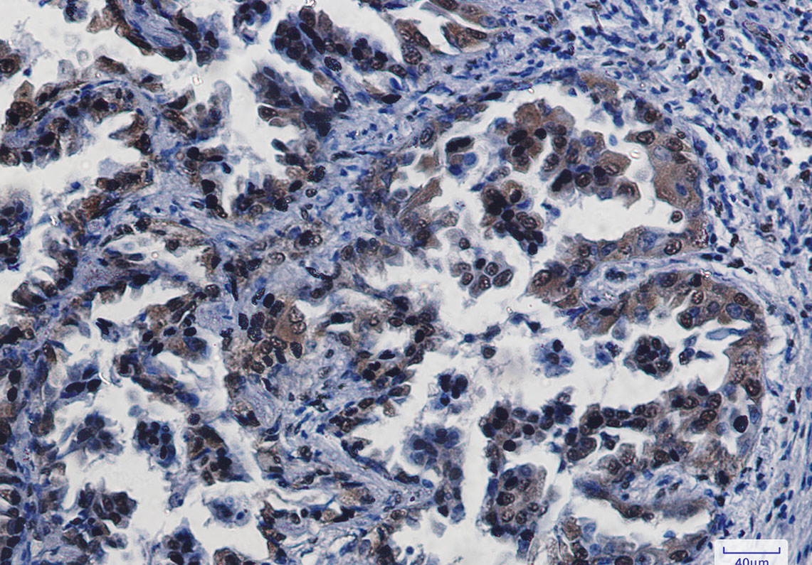 CREB Rabbit mAb