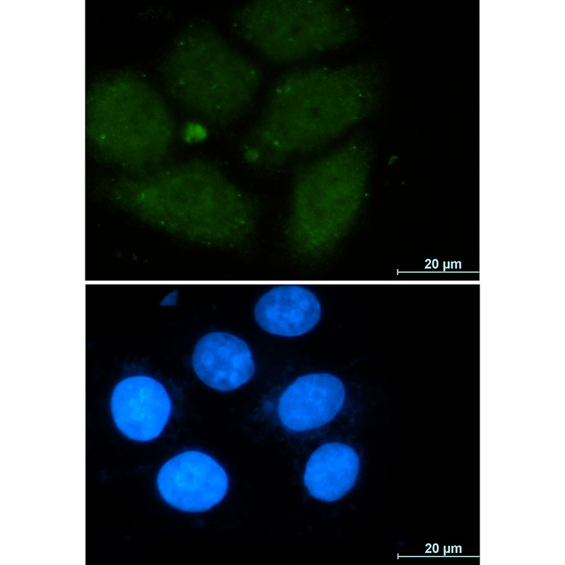 CRM1 Rabbit mAb