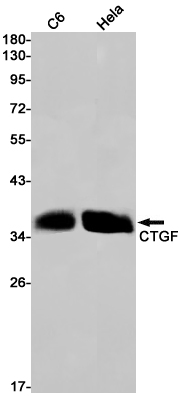 CTGF Rabbit mAb