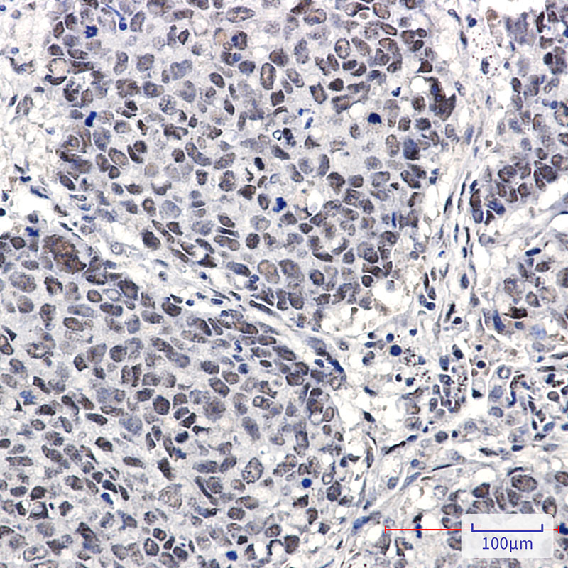 Cullin 4A/4B Rabbit mAb