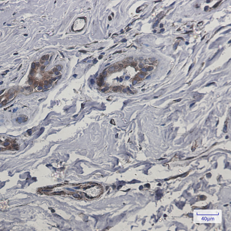 CYB5R3 Rabbit mAb