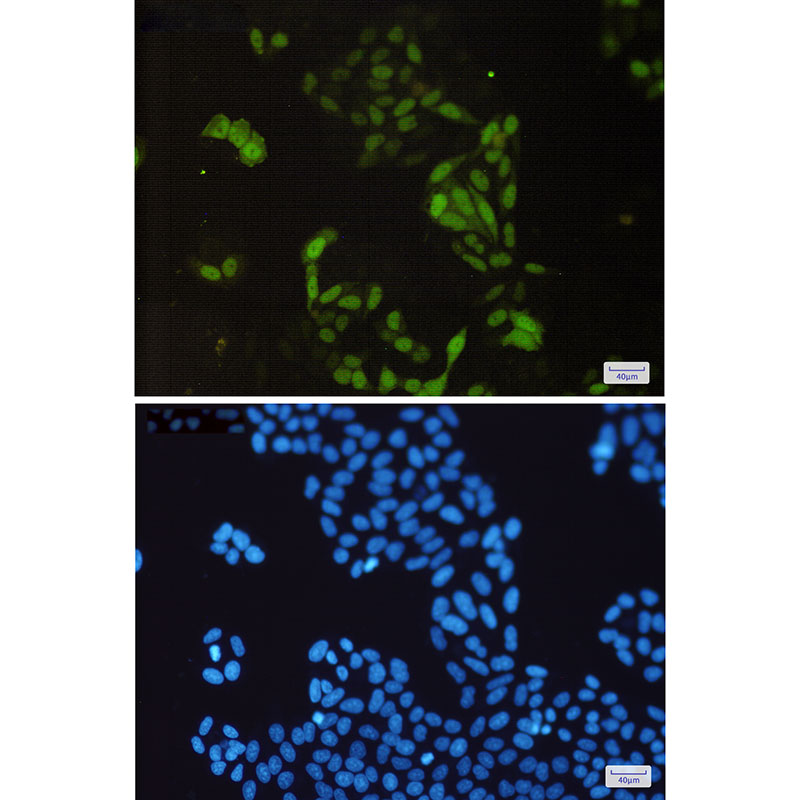 Cyclin A2 Rabbit mAb