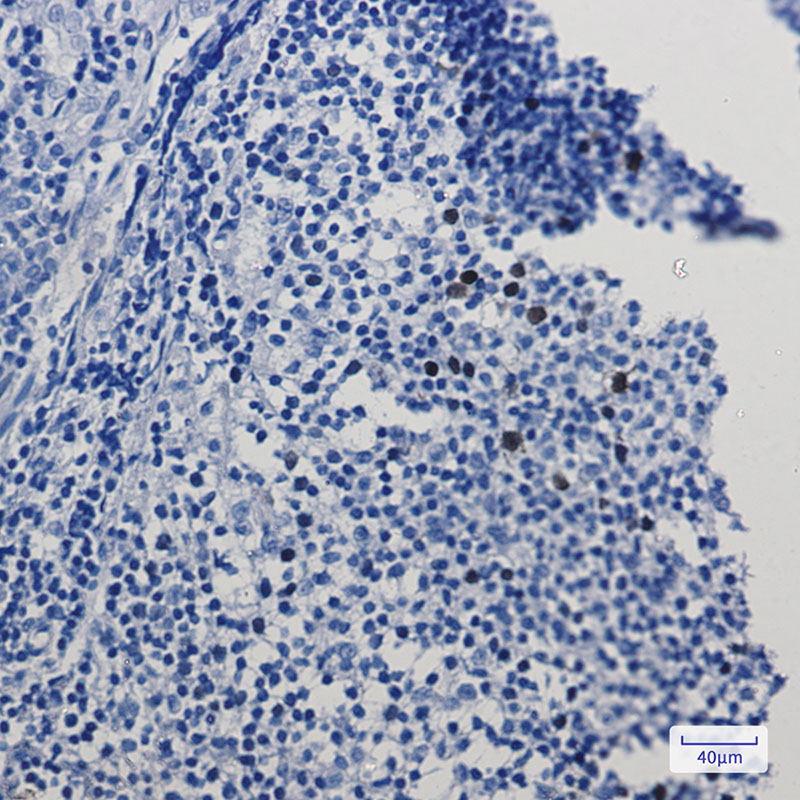 Cyclin A2 Rabbit mAb