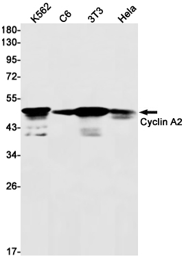 Cyclin A2 Rabbit mAb