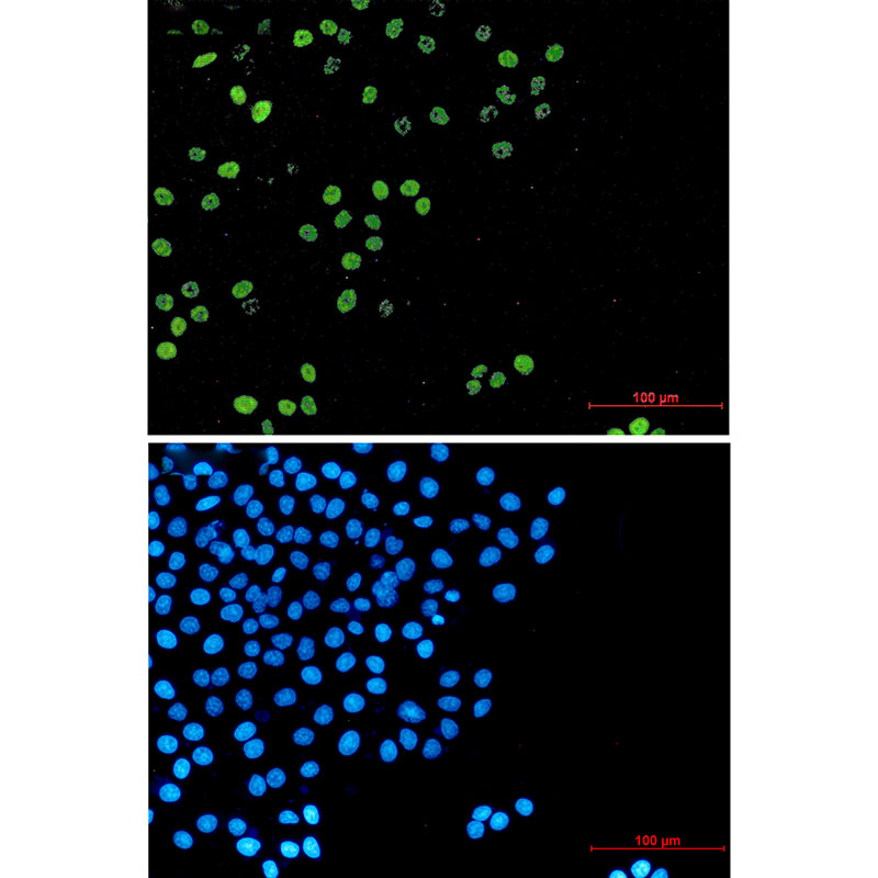 Cyclin A2 Rabbit mAb