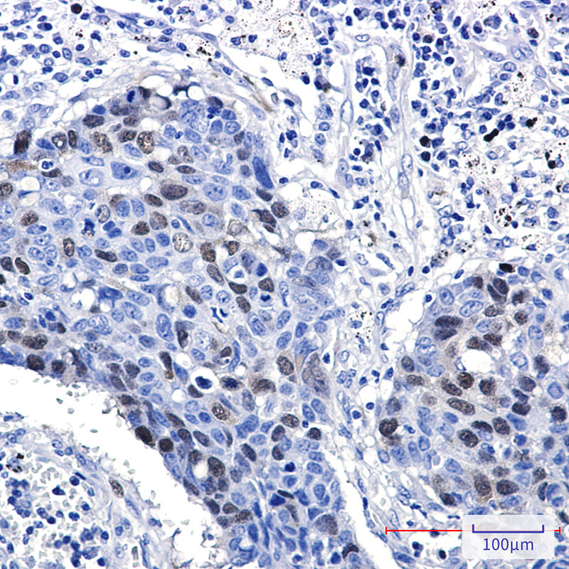 Cyclin A2 Rabbit mAb