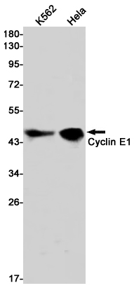 Cyclin E1 Rabbit mAb