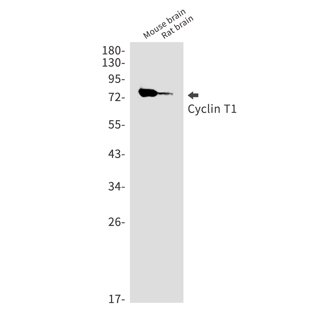 Cyclin T1 Rabbit mAb