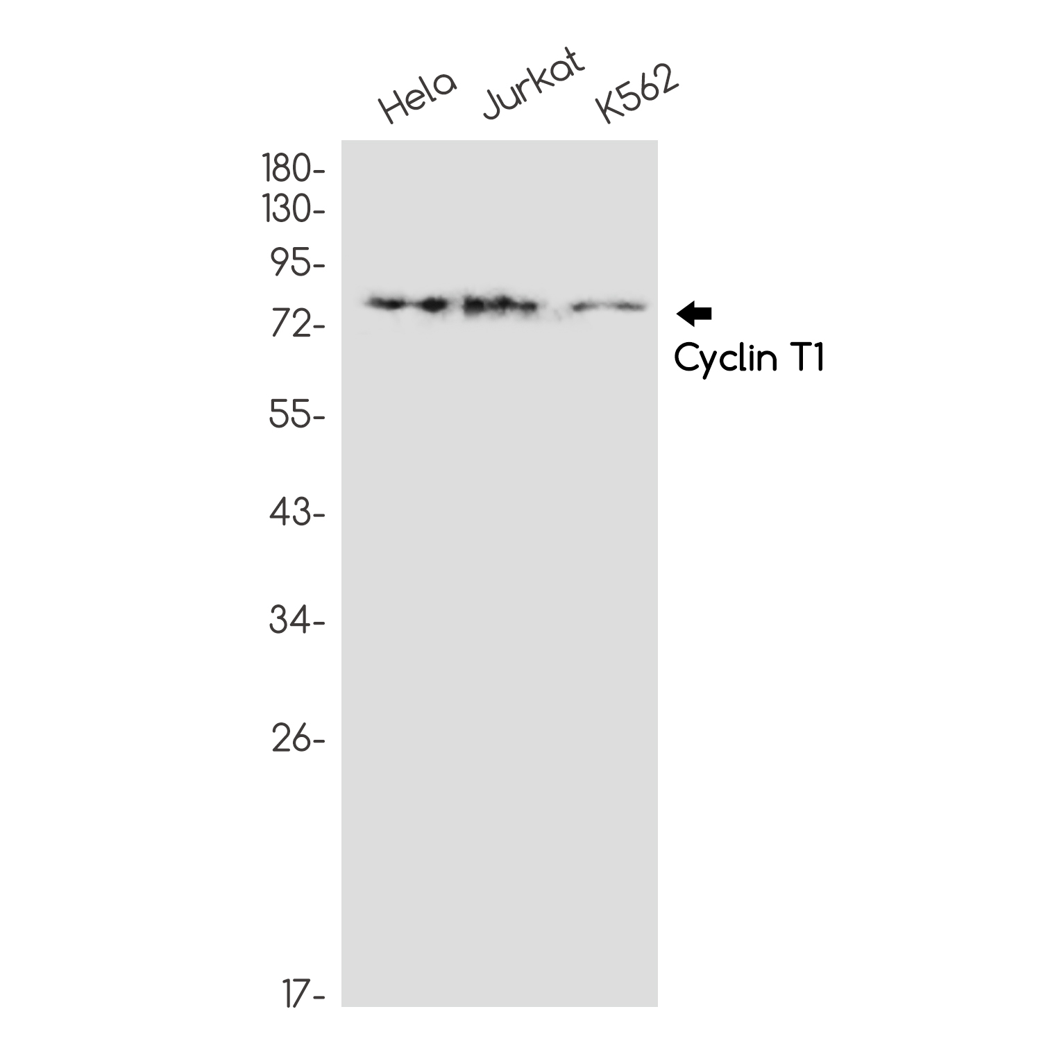 Cyclin T1 Rabbit mAb