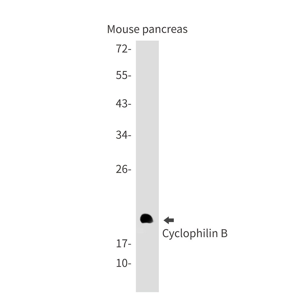 Cyclophilin B Rabbit mAb