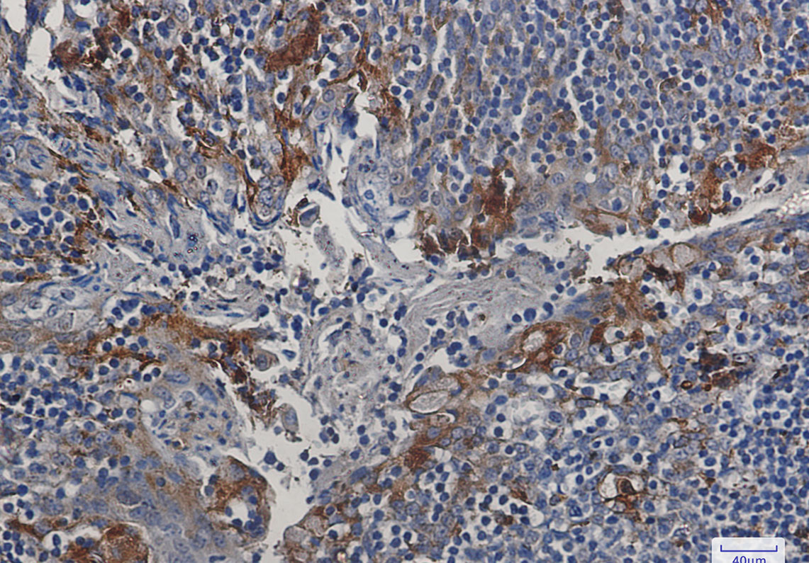 Cystatin C Rabbit mAb