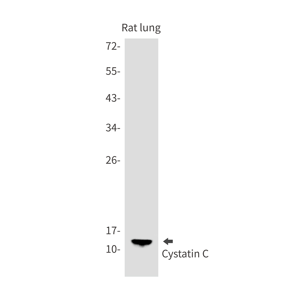 Cystatin C Rabbit mAb