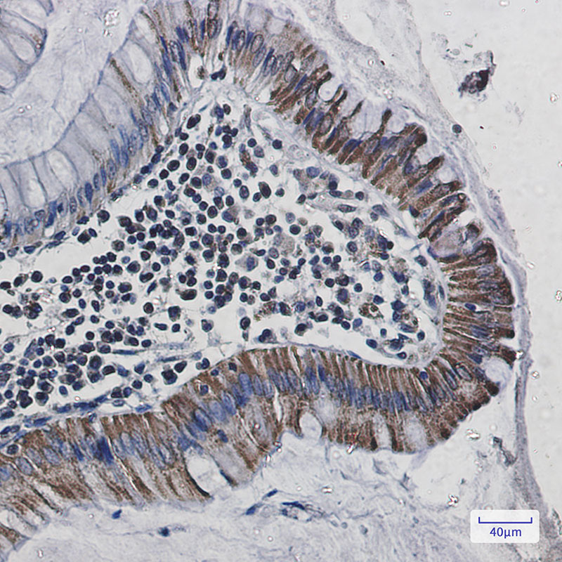 Cytochrome C Oxidase subunit Vic Rabbit mAb