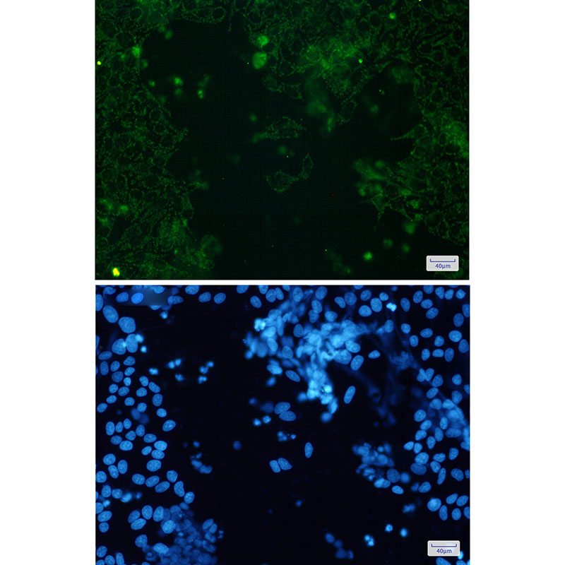 Cytochrome P450 17A1 Rabbit mAb