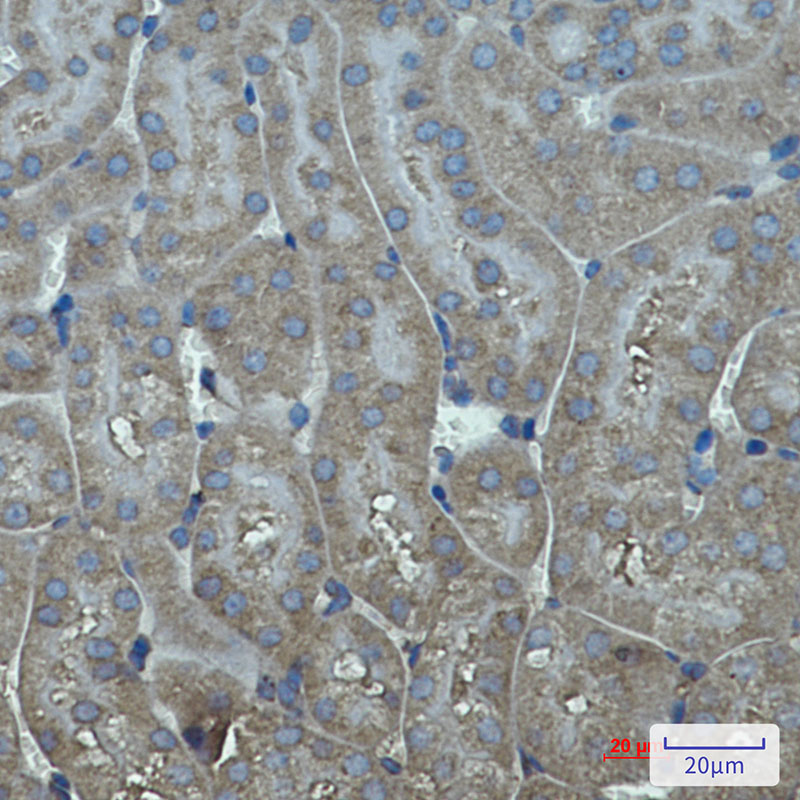 Cytochrome P450 17A1 Rabbit mAb