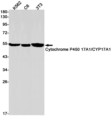 Cytochrome P450 17A1 Rabbit mAb