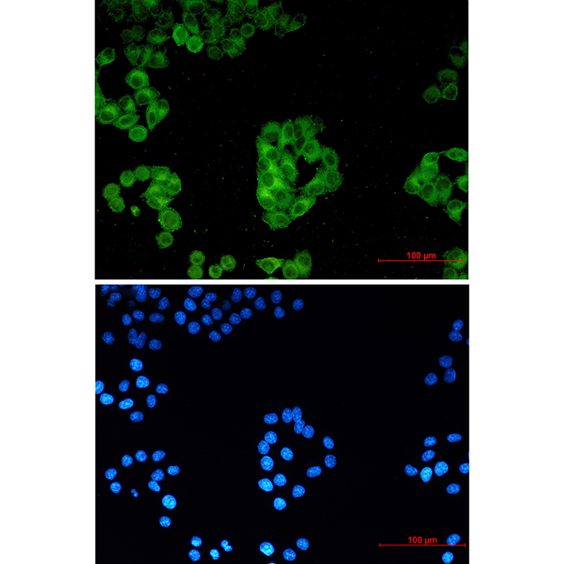 Cytochrome P450 Reductase Rabbit mAb