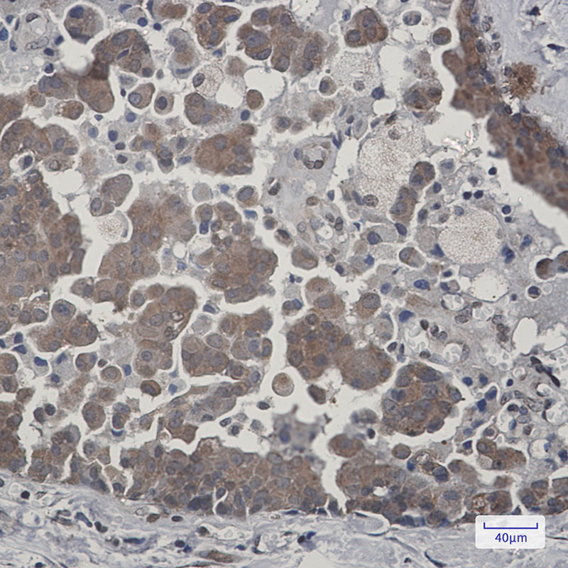 Cytochrome P450 Reductase Rabbit mAb