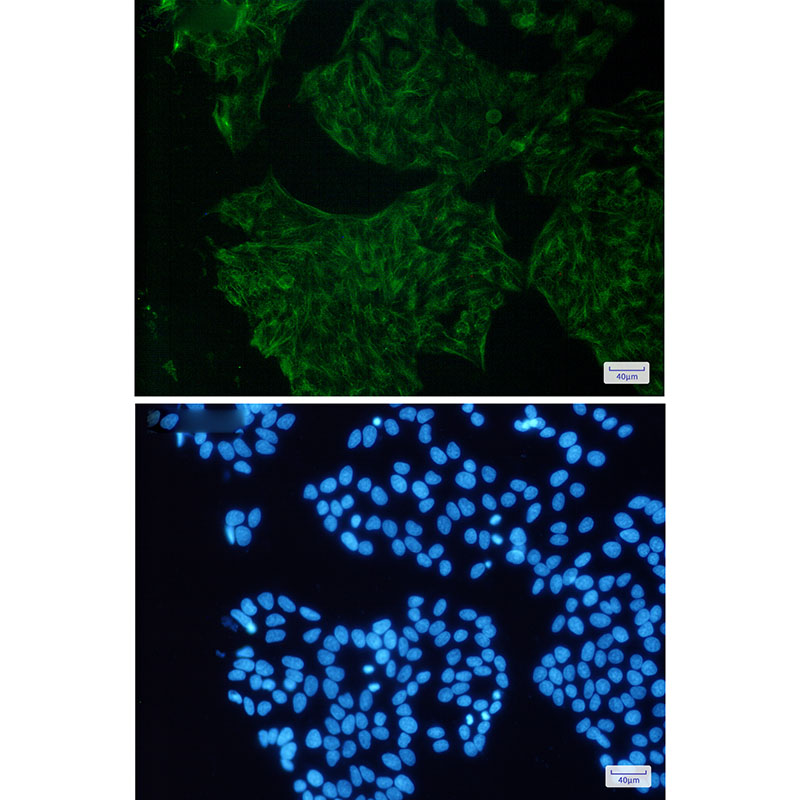 Cytokeratin 18 Rabbit mAb