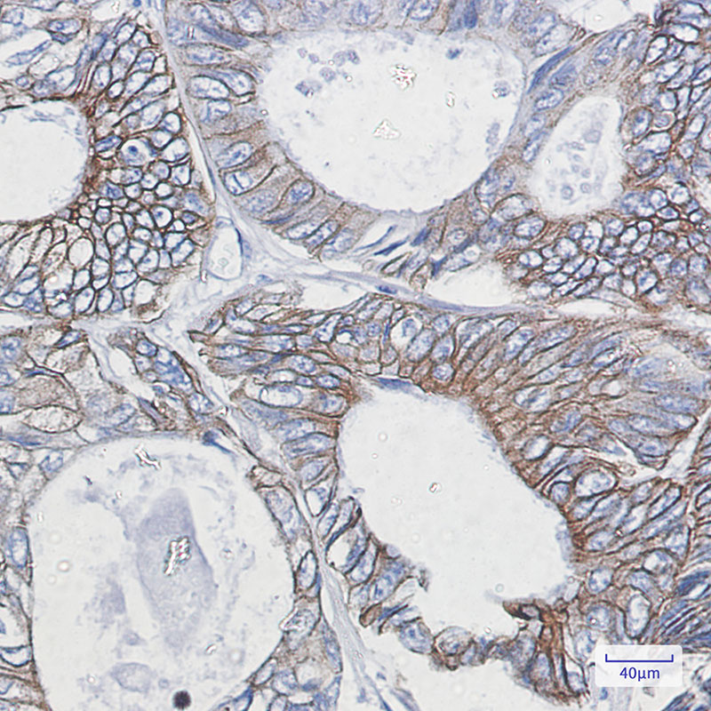 Cytokeratin 18 Rabbit mAb