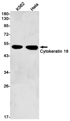 Cytokeratin 18 Rabbit mAb