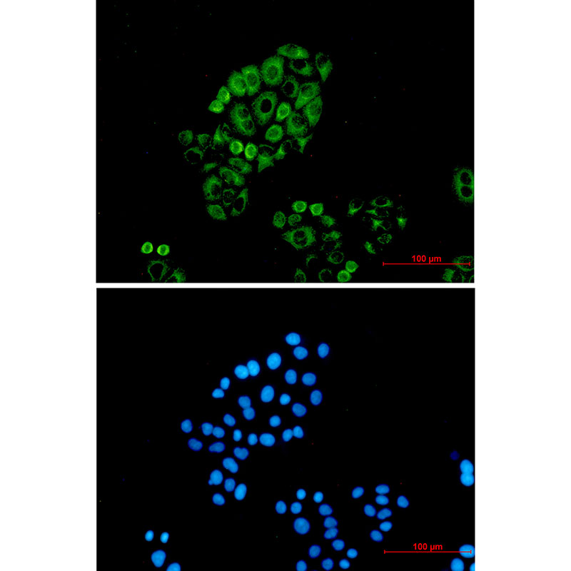 Cytokeratin 18 Rabbit mAb