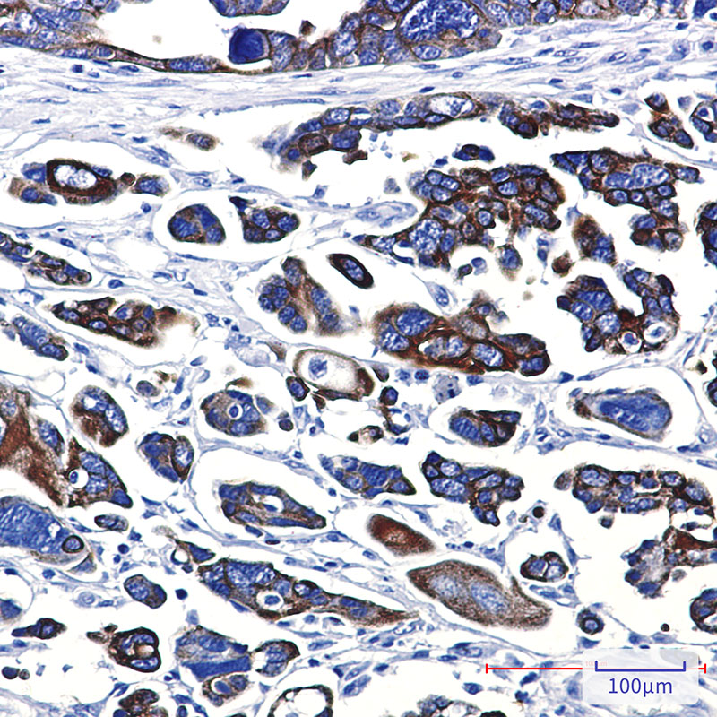 Cytokeratin 18 Rabbit mAb