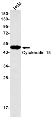 Cytokeratin 18 Rabbit mAb