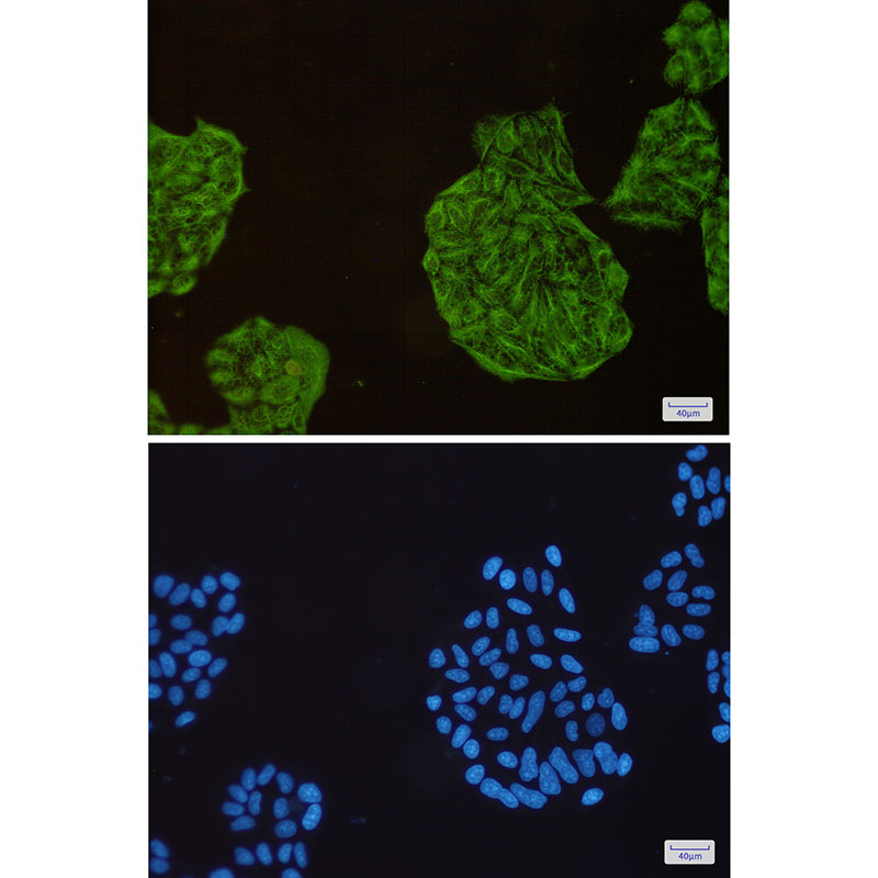 Cytokeratin 18 Rabbit mAb