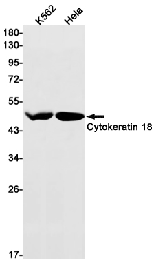 Cytokeratin 18 Rabbit mAb