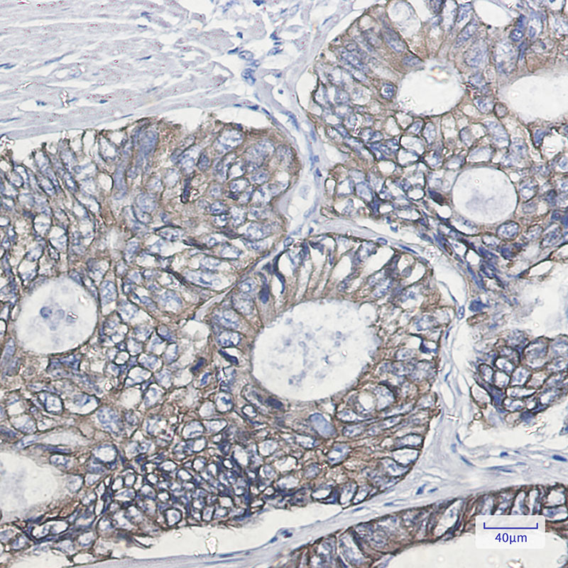 Cytokeratin 19 Rabbit mAb