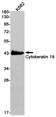 Cytokeratin 19 Rabbit mAb