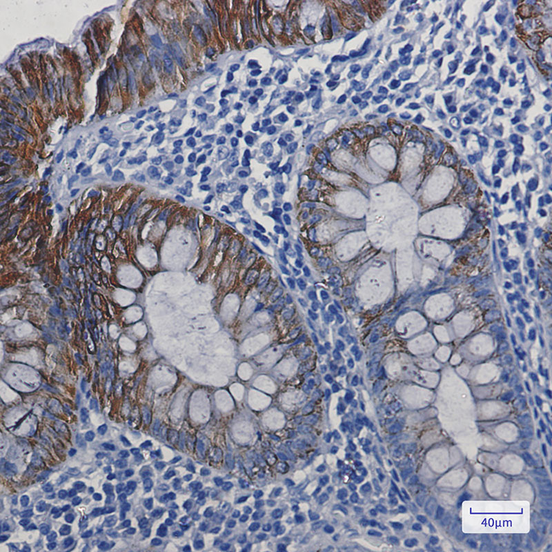 Cytokeratin 19 Rabbit mAb