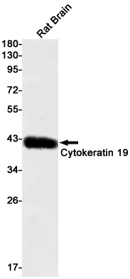 Cytokeratin 19 Rabbit mAb