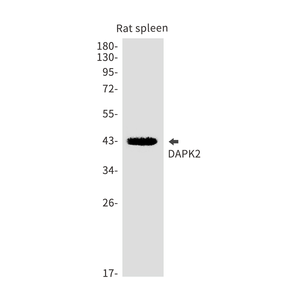 DAPK2 Rabbit mAb