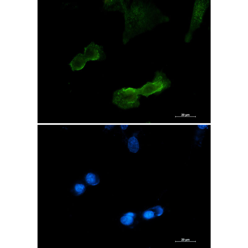 DCAMKL1 Rabbit mAb