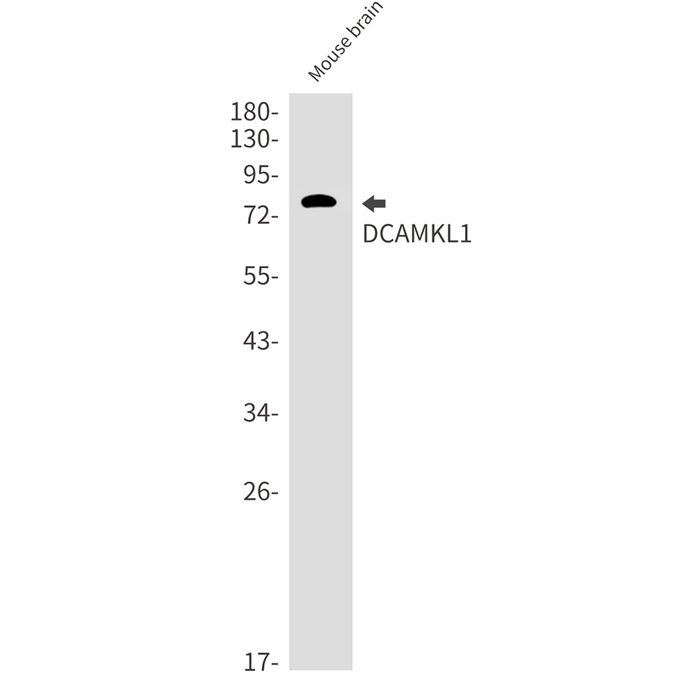 DCAMKL1 Rabbit mAb