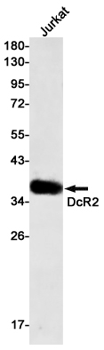 DcR2 Rabbit mAb